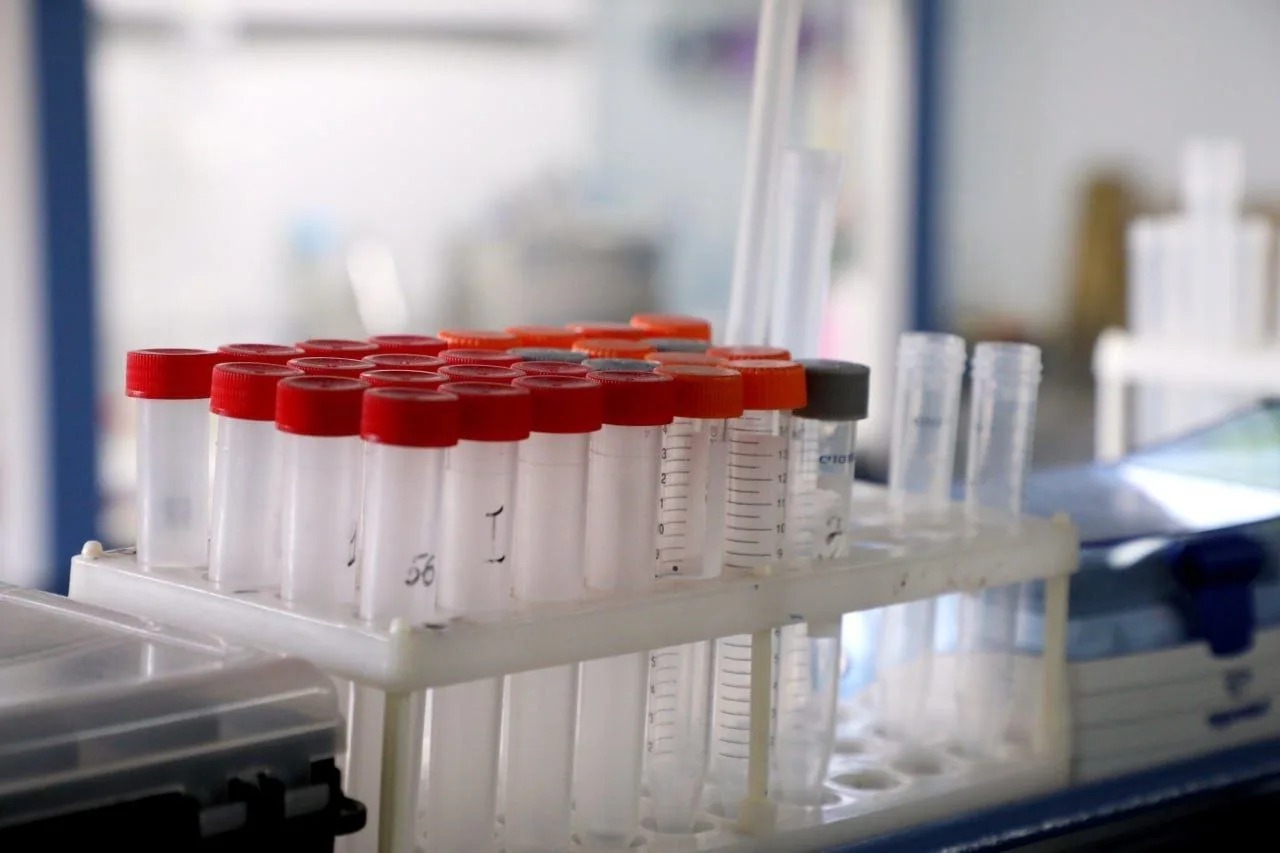 Свыше 120 тысяч волгоградцев обследовались на гепатит С в 2025 году